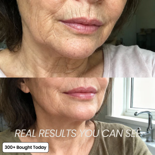 Transform Wrinkles, Fine Lines, And Tired Creases Naturally